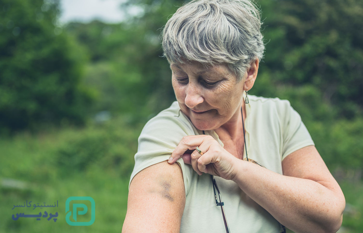 اولین علائم سرطان خون در زنان چیست؟ - 44