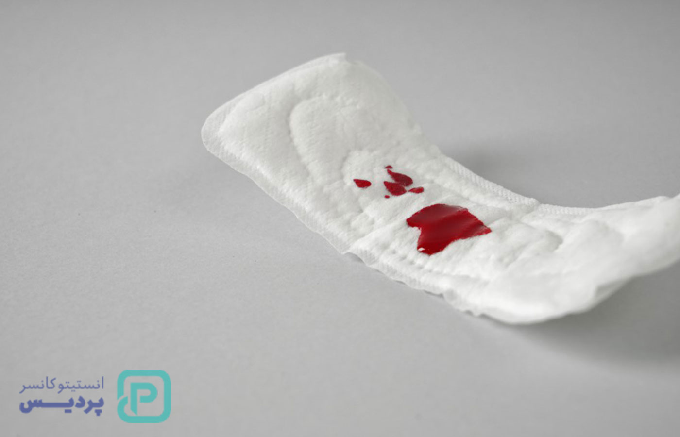 علائم سرطان رحم: نشانههایی که هر زنی باید بشناسد 3 علائم سرطان رحم: نشانههایی که هر زنی باید بشناسد - 3