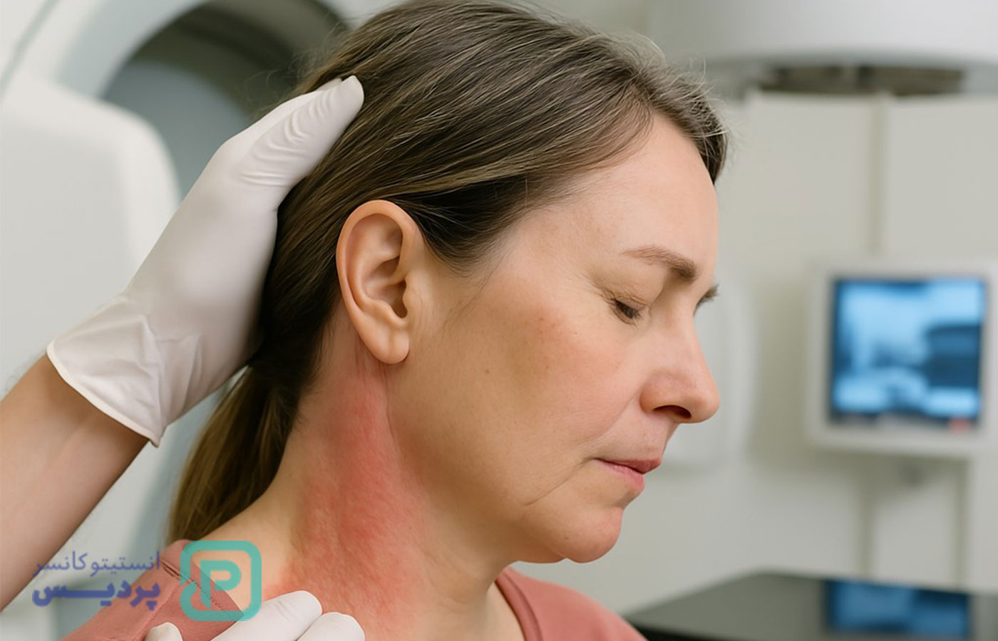 عوارض پرتودرمانی بعد از درمان سرطان؛ چه چیزهایی طبیعیه و چطور می‌تونیم باهاش کنار بیایم؟ - 2