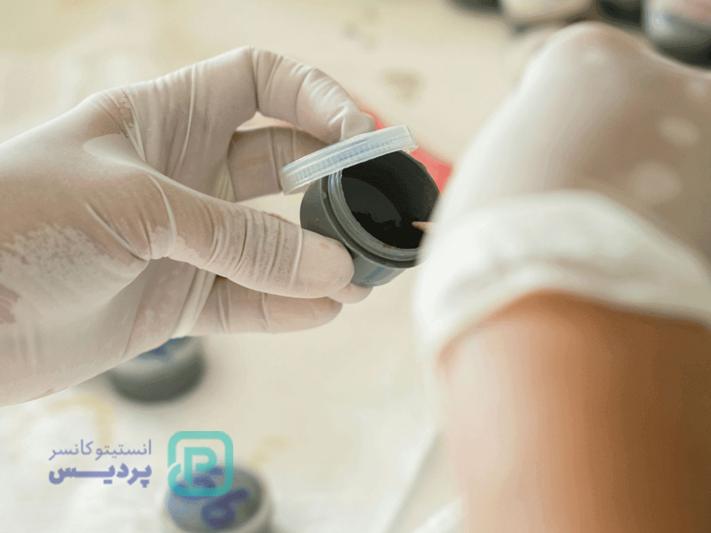 تست سرطان معده در منزل؛ واقعیت یا شایعه؟ 5 تست سرطان معده در منزل-5