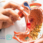 تست سرطان معده در منزل