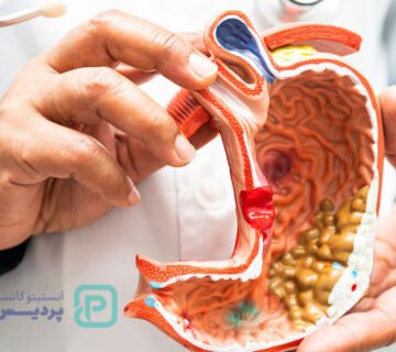 تست سرطان معده در منزل؛ واقعیت یا شایعه؟ 4 تست سرطان معده در منزل