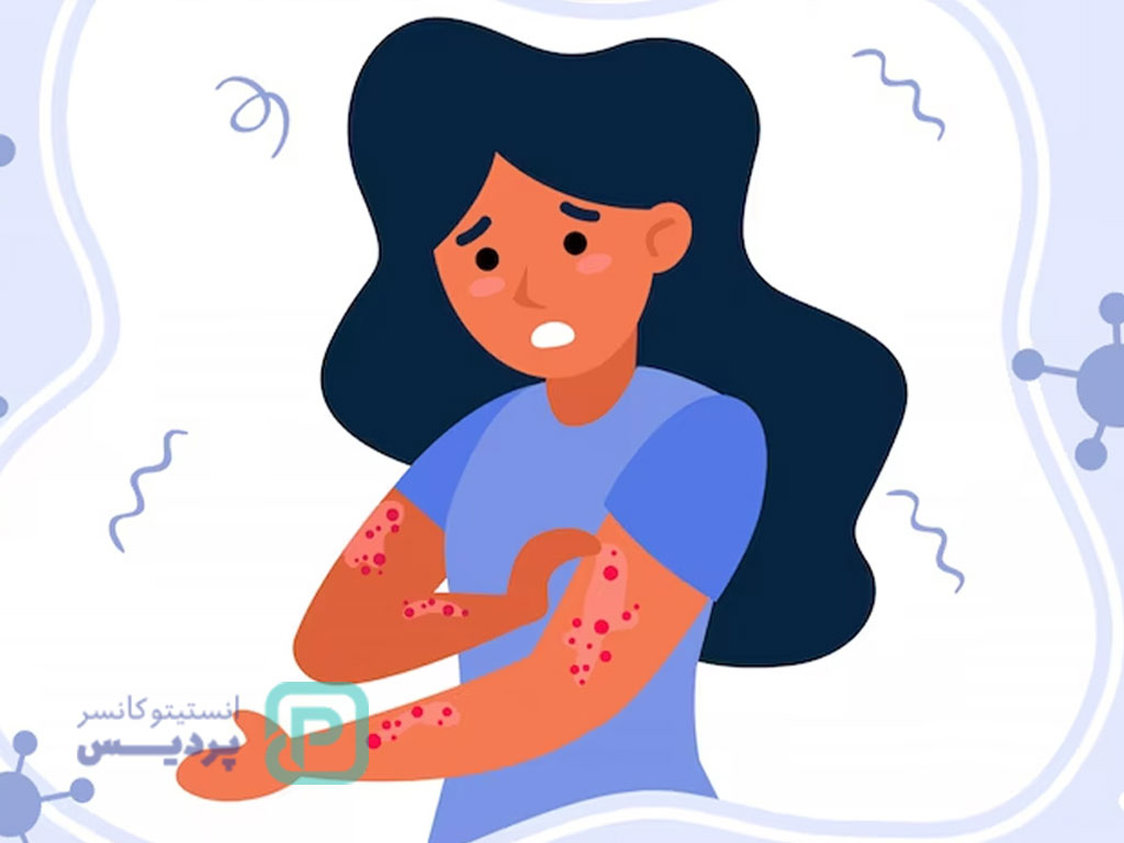 خطرناک‌ترین بیماری خودایمنی-1