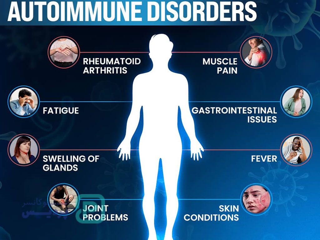 خطرناک‌ترین بیماری خودایمنی-6