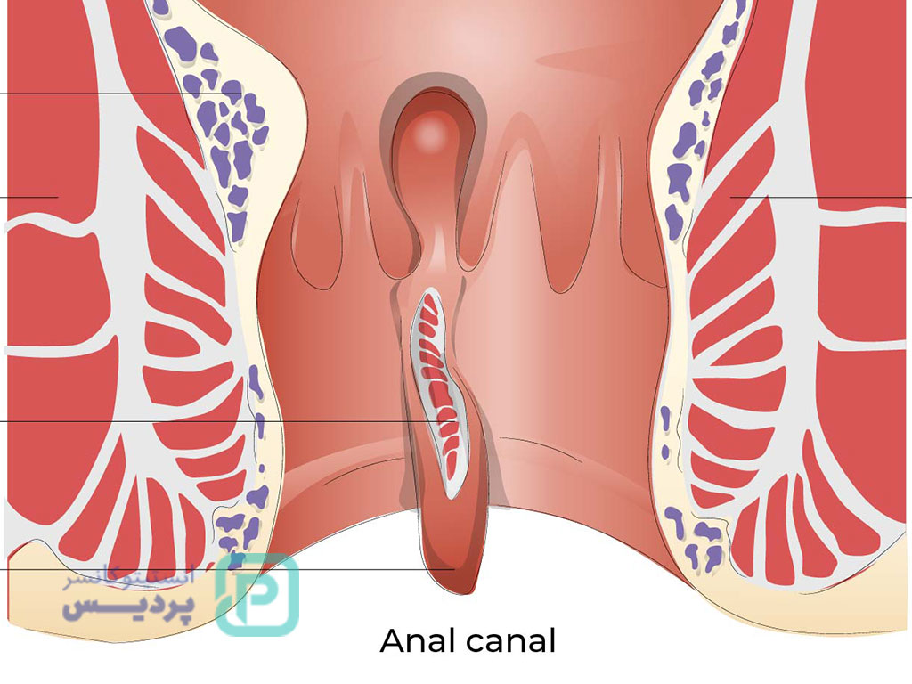 علت خونریزی هنگام دفع مدفوع بدون درد؛ آیا باید نگران باشیم؟ 3 خونریزی هنگام دفع مدفوع بدون درد-2