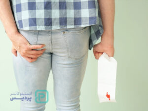 خونریزی هنگام دفع مدفوع بدون درد