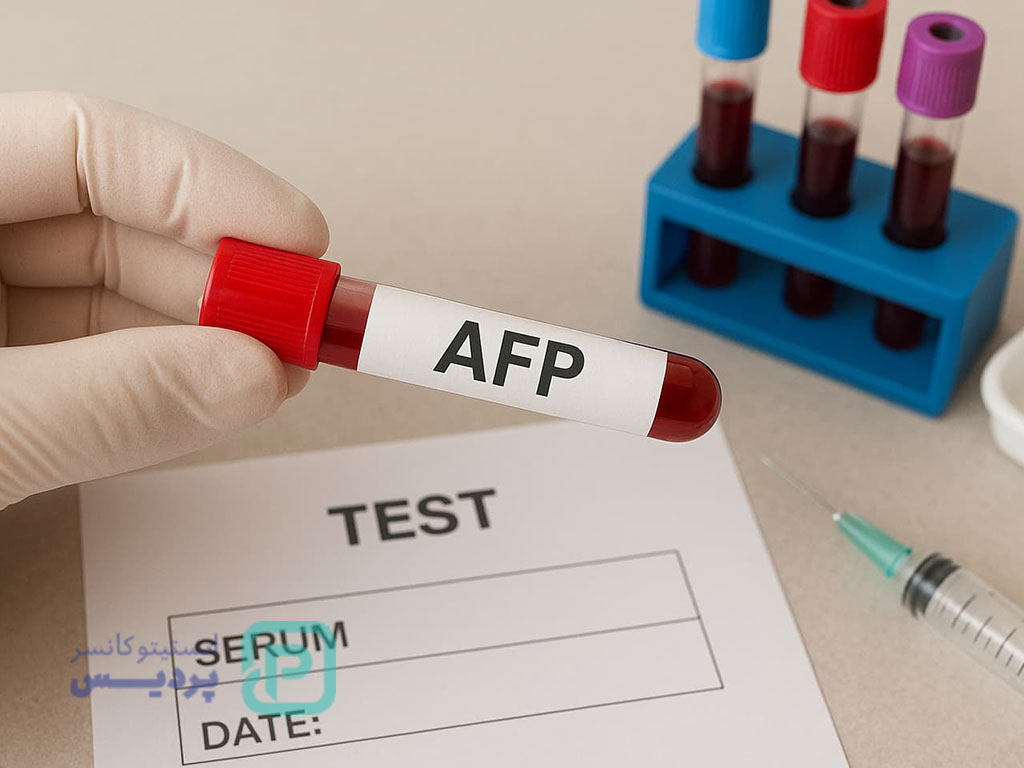 علائم سرطان کبد؛ نشانههای هشداردهنده را بشناسید 5 علائم سرطان کبد-6