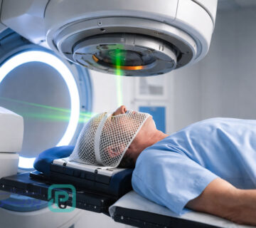 رادیوتراپی مغز: راهنمای کامل برای بیماران و خانوادهها 1 رادیوتراپی مغز