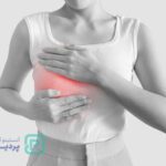 پاپیلوم سینه