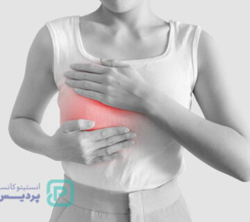 پاپیلوم سینه چیست؟ علائم، علت، تشخیص و درمان 3 پاپیلوم سینه