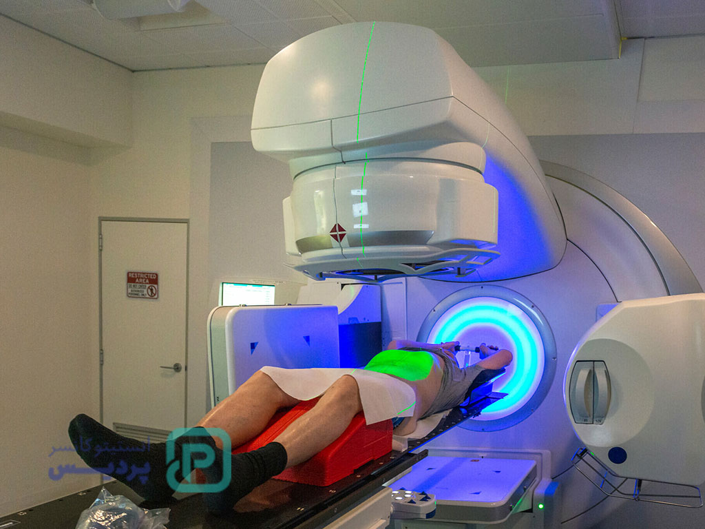 رادیوتراپی پروستات چقدر مؤثر است؟ 5 رادیوتراپی پروستات-5