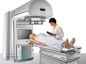 رادیوتراپی پروستات