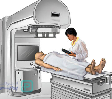 رادیوتراپی پروستات