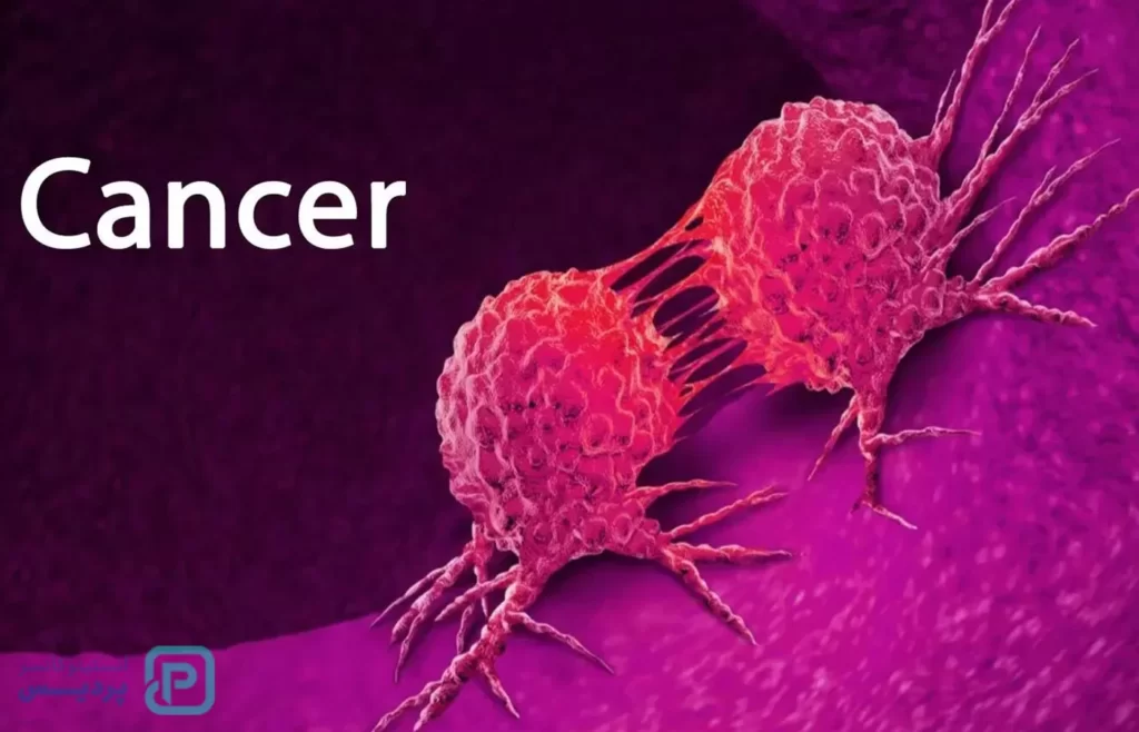 همه چیز درباره سرطان؛ علت، درمان و راه های پیشگیری آن را بشناسید 2 همه چیز درباره سرطان؛ علت، درمان و راه های پیشگیری آن را بشناسید - 1