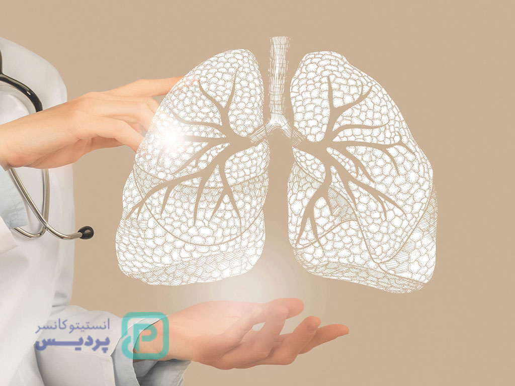 سرطان ریه قابل درمان است؟
