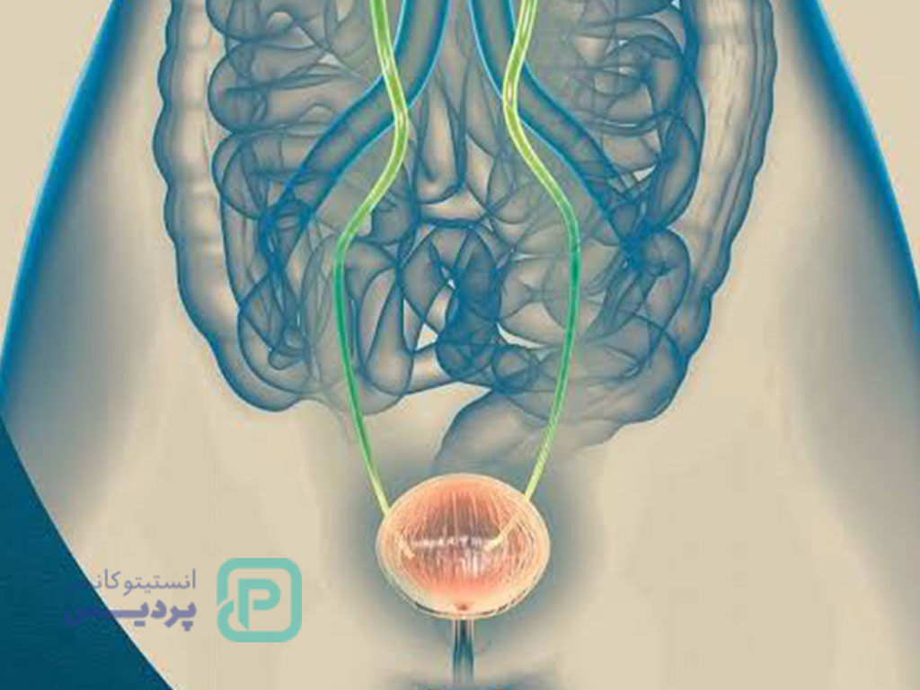 علائم اولیه سرطان مثانه
