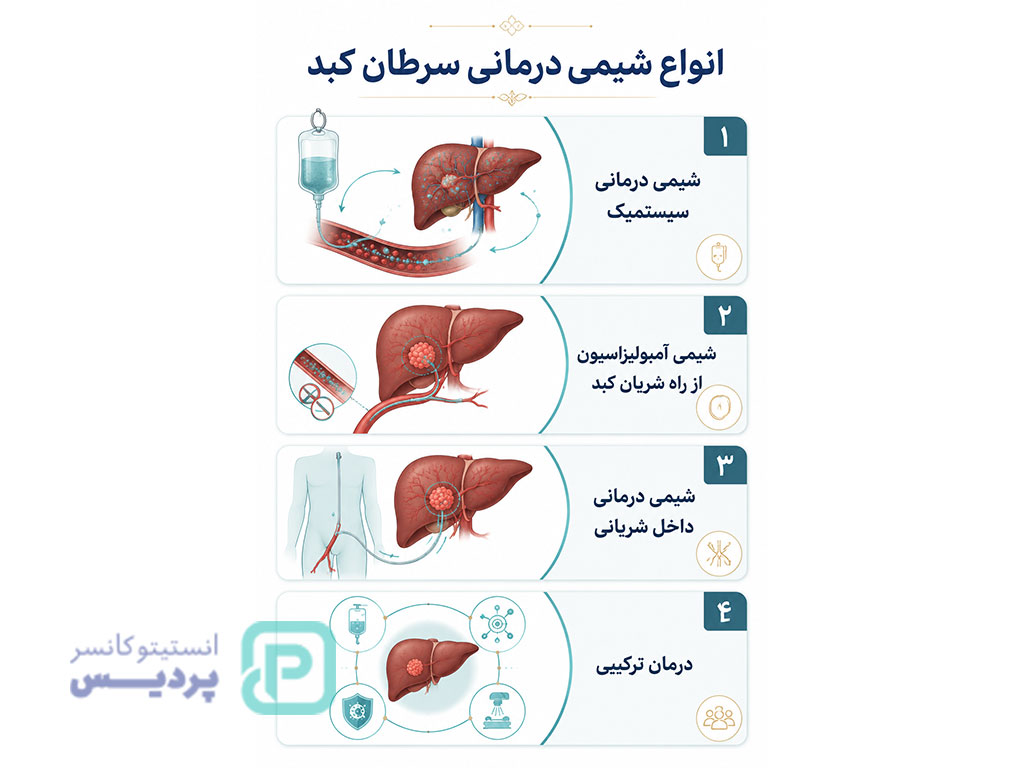 شیمی درمانی سرطان کبد؛ روش درمان، داروها، عوارض و میزان اثربخشی 3 انواع شیمی درمانی سرطان کبد