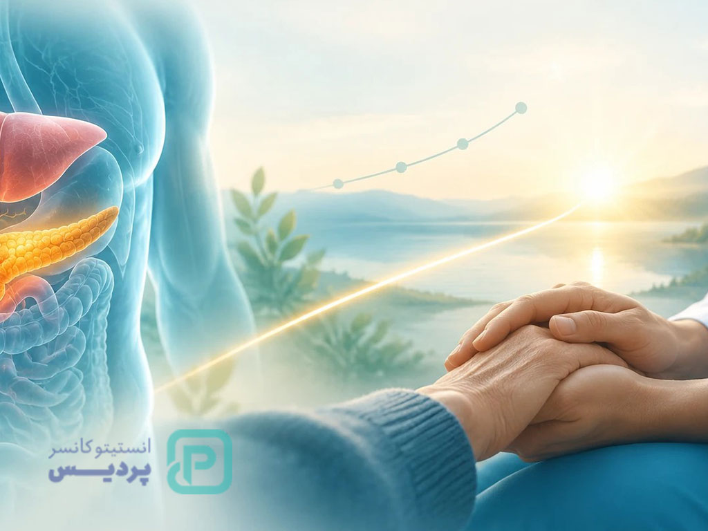 تشخیص و درمان سرطان پانکراس با متاستاز کبدی 5 طول عمر سرطان پانکراس