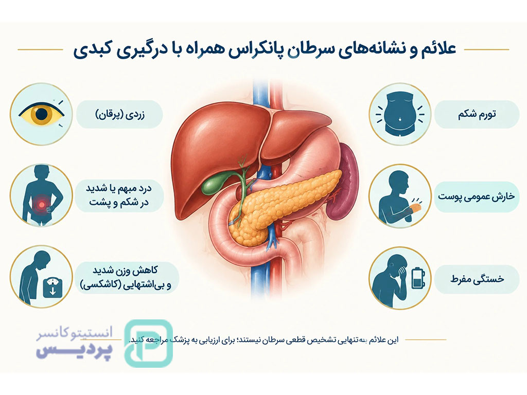 تشخیص و درمان سرطان پانکراس با متاستاز کبدی 3 علائم و نشانههای سرطان پانکراس همراه با درگیری کبدی