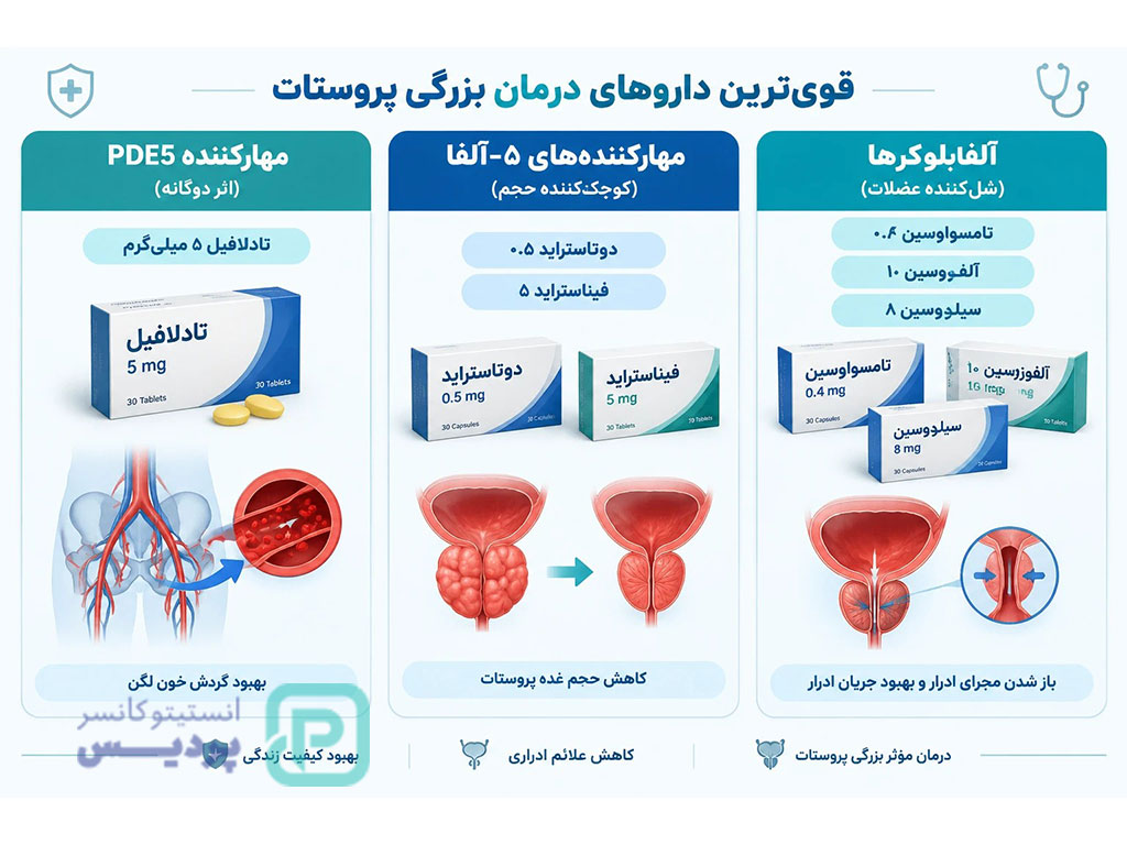 داروی درمان قطعی پروستات؛ بررسی موثرترین داروها 2 داروهای درمان پروستات